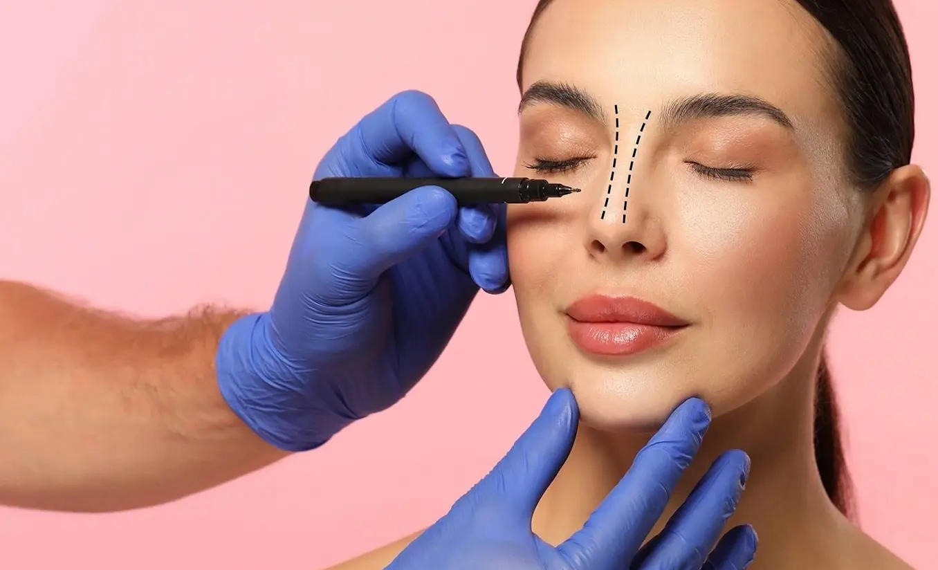 Rhinoplastie par ultrasons