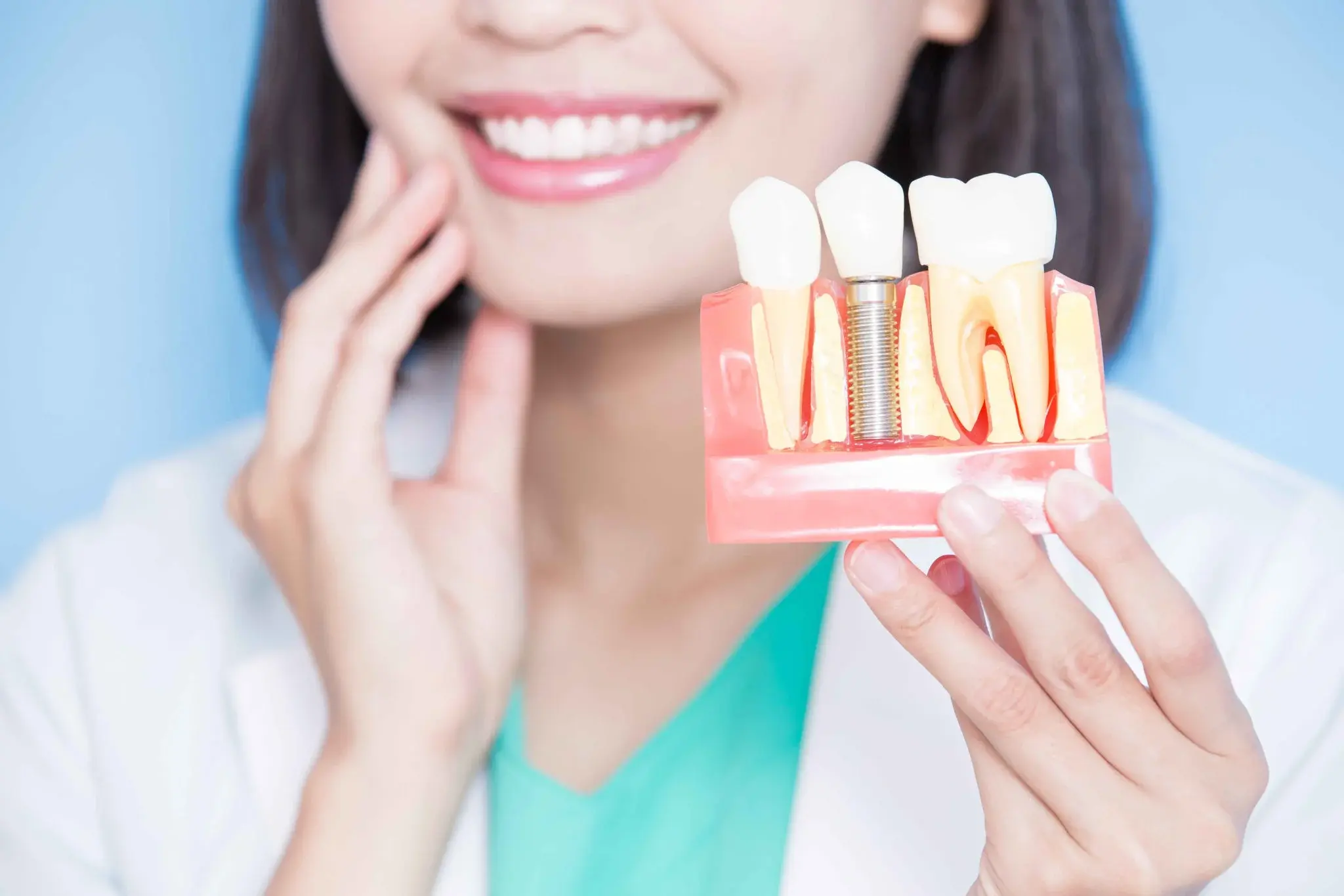 Dental implants