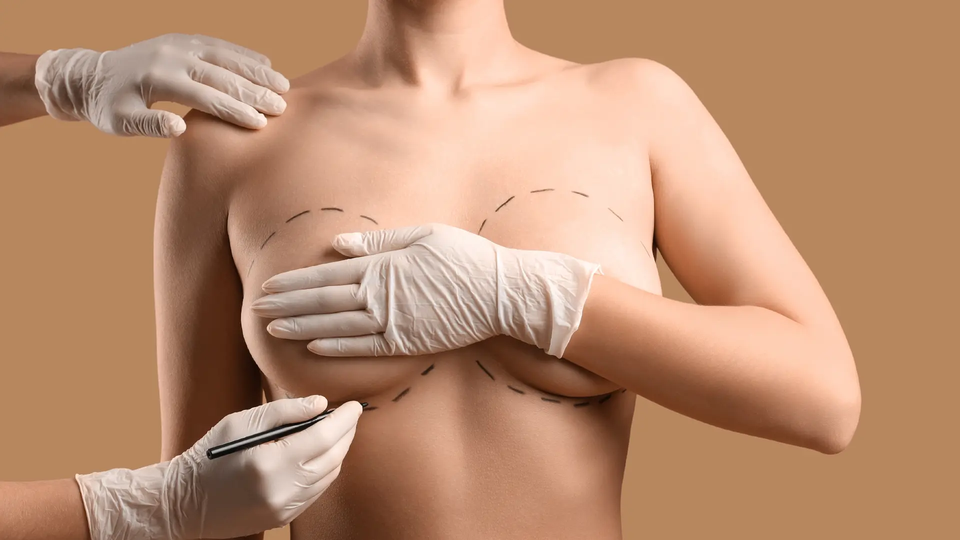 Correction des seins tubéreux